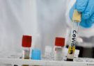 واکسن چینی کووید-۱۹ تا پایان ۲۰۲۰ عرضه می‌شود
