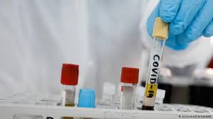 واکسن چینی کووید-۱۹ تا پایان ۲۰۲۰ عرضه می‌شود