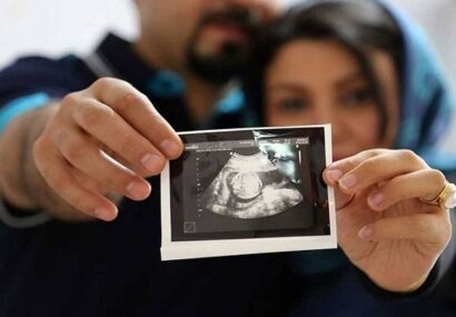 خدمات درمان ناباروری در ۷ مرکز مازندران؛ گامی مهم در راستای قانون جوانی جمعیت